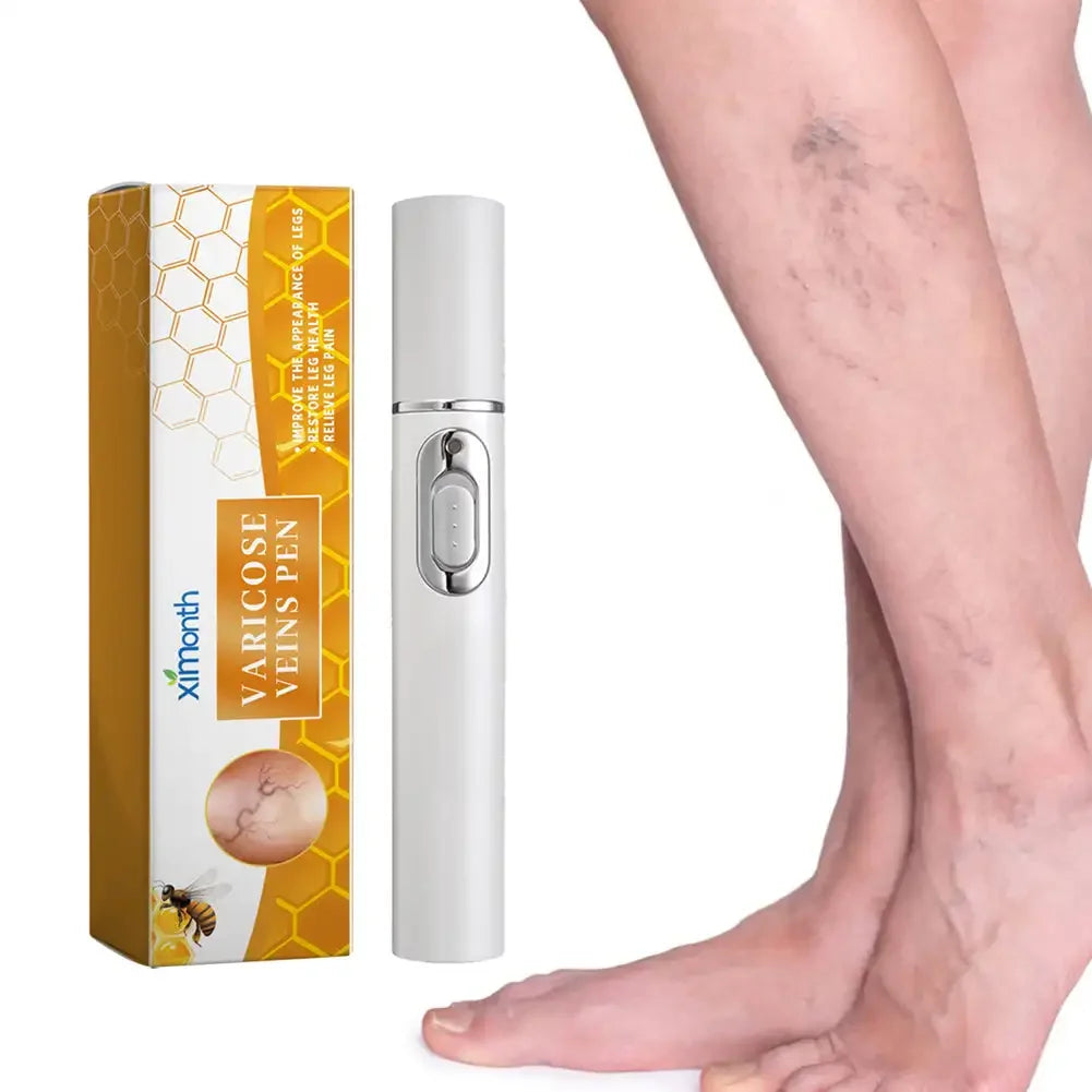 Varicose Vens Pen Repair Vasculitis Phlebitis Soothe Skin Relieve Varicose Feet Blood Vessel Blockage Body Health Care